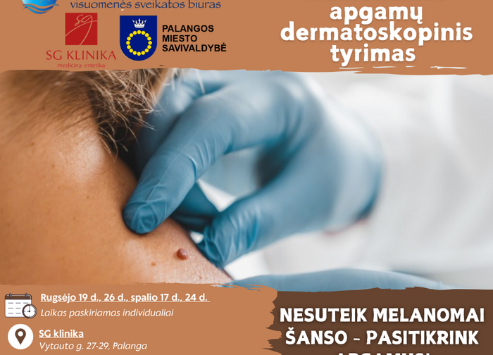 Kviečia pasitikrinti - atvykite nemokamo dermatoskopinio tyrimo 